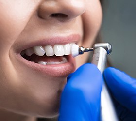 Tooth getting scrubbed clean