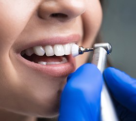 Tooth getting scrubbed clean